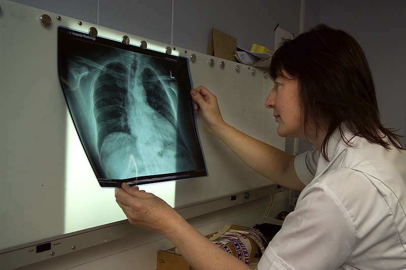 Consultant Radiologist in Birmingham